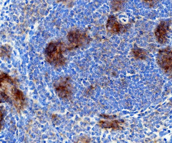 Rad17 Rabbit Polyclonal Antibody