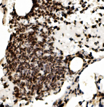 RCC1 Rabbit Polyclonal Antibody