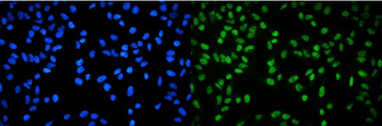 RPA32/RPA2 Rabbit Polyclonal Antibody