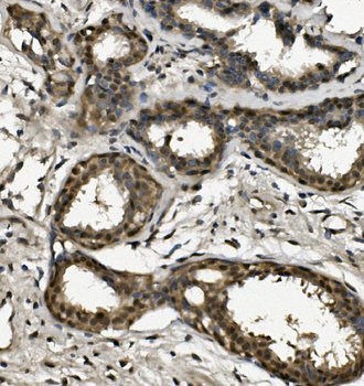 RPA32/RPA2 Rabbit Polyclonal Antibody