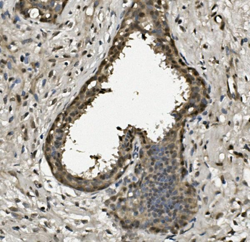 RPA32/RPA2 Rabbit Polyclonal Antibody