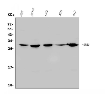 RPA32/RPA2 Rabbit Polyclonal Antibody