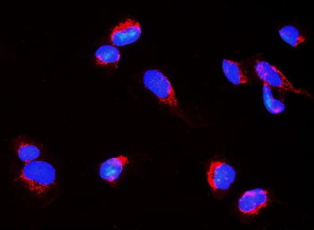 Nogo A/RTN4 Rabbit Polyclonal Antibody