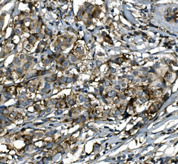 SGK1 Rabbit Polyclonal Antibody