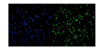Transketolase/TKT Rabbit Polyclonal Antibody