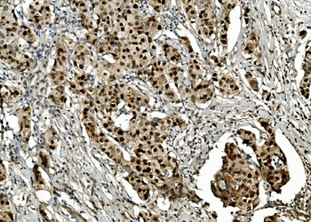 Transketolase/TKT Rabbit Polyclonal Antibody