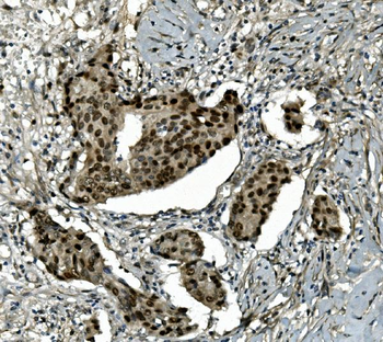 Transketolase/TKT Rabbit Polyclonal Antibody