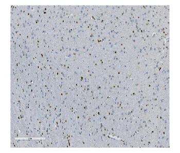 Transketolase/TKT Rabbit Polyclonal Antibody