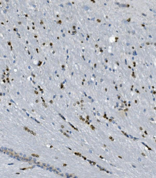 Transketolase/TKT Rabbit Polyclonal Antibody