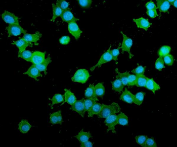 AKAP12 Rabbit Polyclonal Antibody