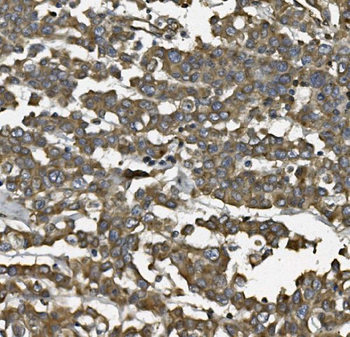 ALDH1L1 Rabbit Polyclonal Antibody