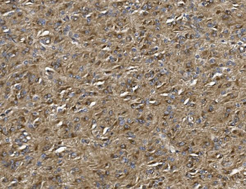 ALDH1L1 Rabbit Polyclonal Antibody