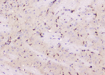 ALDH1L1 Rabbit Polyclonal Antibody