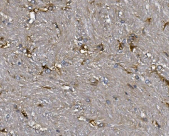 ALDH1L1 Rabbit Polyclonal Antibody