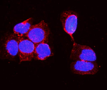 Alkaline phosphatase/ALPL Rabbit Polyclonal Antibody