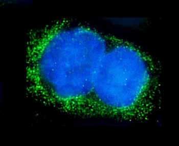 Alkaline phosphatase/ALPL Rabbit Polyclonal Antibody