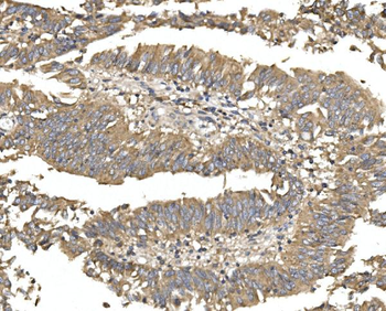 Alkaline phosphatase/ALPL Rabbit Polyclonal Antibody