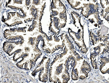 ARG2 Rabbit Polyclonal Antibody
