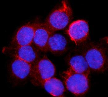 BDH1 Rabbit Polyclonal Antibody