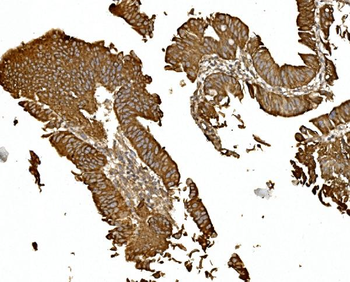 BDH1 Rabbit Polyclonal Antibody