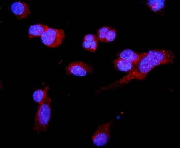 C5a-R/C5ar1 Rabbit Polyclonal Antibody