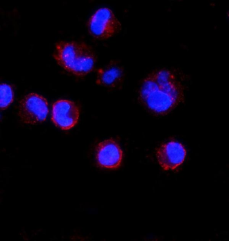 CD74 Rabbit Polyclonal Antibody