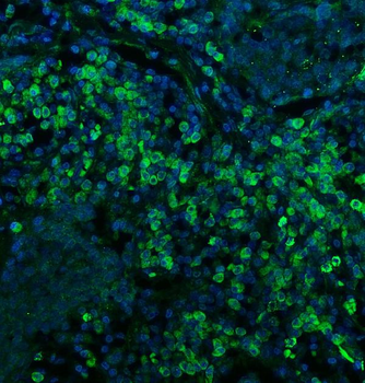 CD74 Rabbit Polyclonal Antibody