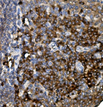 CD74 Rabbit Polyclonal Antibody
