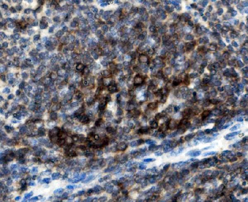 CD74 Rabbit Polyclonal Antibody