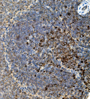 CD74 Rabbit Polyclonal Antibody