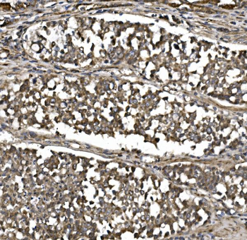 MitoNEET/CISD1 Rabbit Polyclonal Antibody