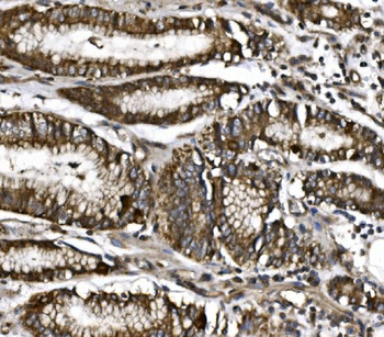 MitoNEET/CISD1 Rabbit Polyclonal Antibody