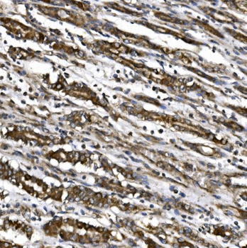 MitoNEET/CISD1 Rabbit Polyclonal Antibody