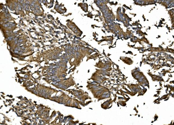 MitoNEET/CISD1 Rabbit Polyclonal Antibody