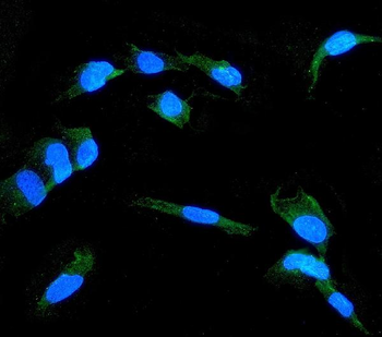 Claudin 1/CLDN1 Rabbit Polyclonal Antibody