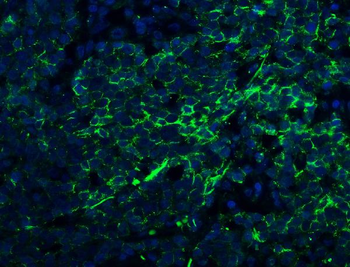 Claudin 1/CLDN1 Rabbit Polyclonal Antibody