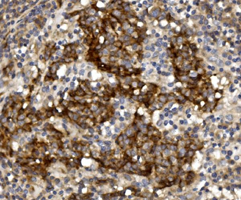 Claudin 1/CLDN1 Rabbit Polyclonal Antibody