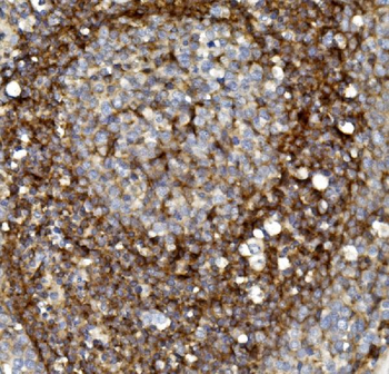 Claudin 1/CLDN1 Rabbit Polyclonal Antibody