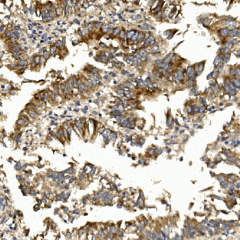 Claudin 1/CLDN1 Rabbit Polyclonal Antibody