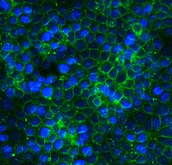 Claudin 3/CLDN3 Rabbit Polyclonal Antibody
