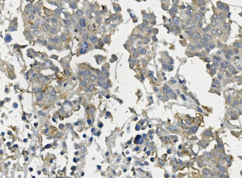 Claudin 3/CLDN3 Rabbit Polyclonal Antibody