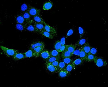 CLDN16/Claudin-16/16 Rabbit Polyclonal Antibody