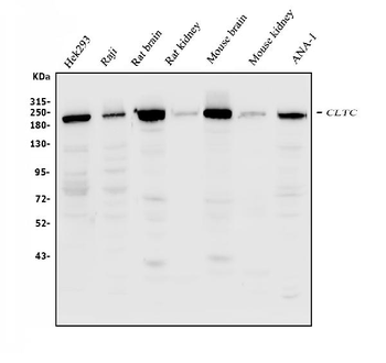 Clathrin heavy chain/CLTC Rabbit Polyclonal Antibody