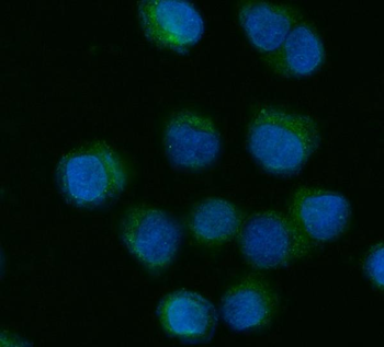 CYP7A1 Rabbit Polyclonal Antibody