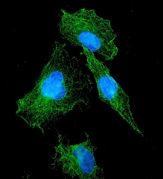 FLT1 Rabbit Polyclonal Antibody