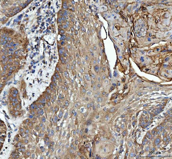 GRB10 Rabbit Polyclonal Antibody