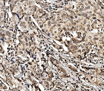 HIF-1 alpha/HIF1A/HIF Rabbit Polyclonal Antibody