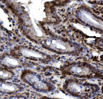 HIF-1 alpha/HIF1A/HIF Rabbit Polyclonal Antibody