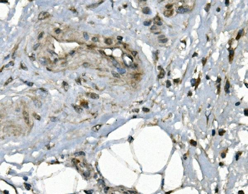 JUNB Rabbit Polyclonal Antibody