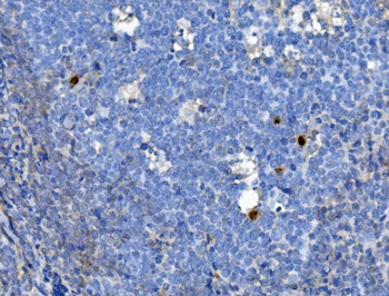 JUNB Rabbit Polyclonal Antibody